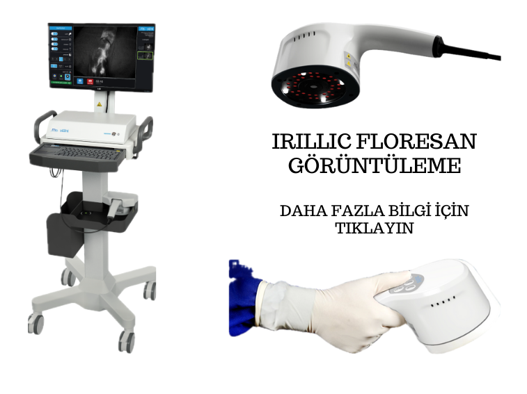 İrillic
